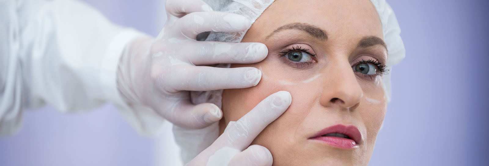 Blepharoplasty